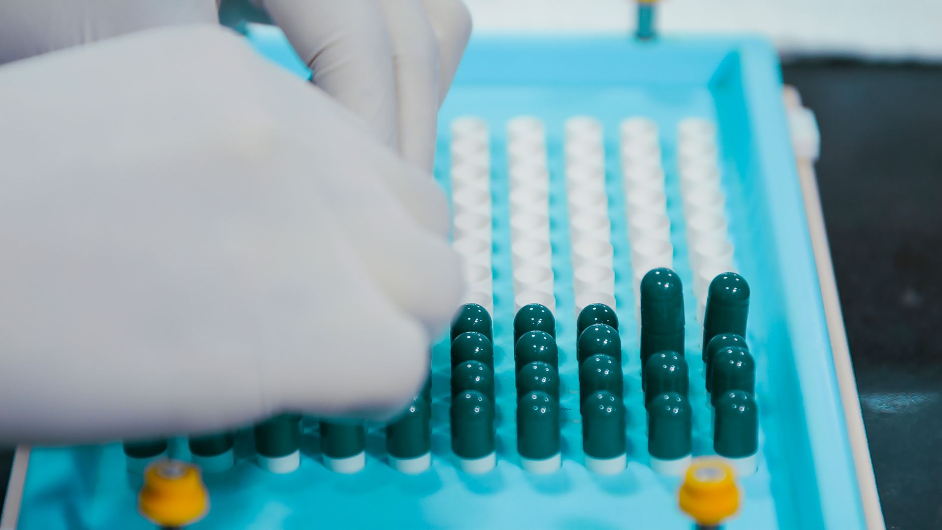 Why Apotex Health Corp stock plummeted yesterday