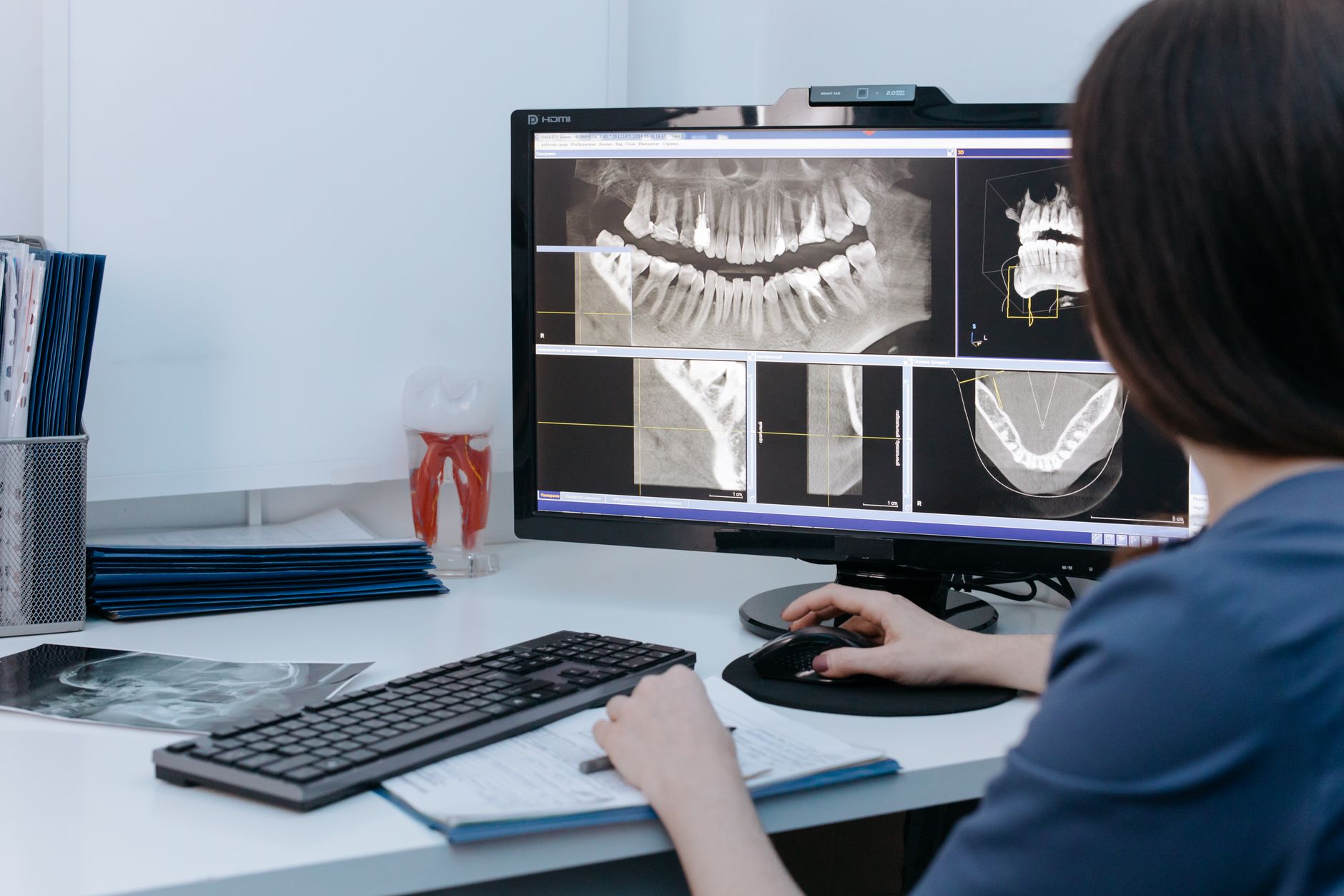 Why GE HealthCare stock is gaining today