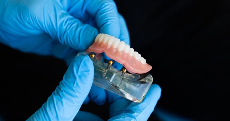 Dentures Cost In Canada: Fix Your Smile (2026)